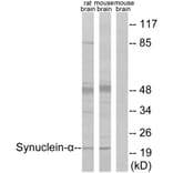 Western Blot - Anti-Synuclein-alpha Antibody (B7234) - Antibodies.com