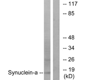 Western Blot - Anti-Synuclein-alpha Antibody (B7235) - Antibodies.com
