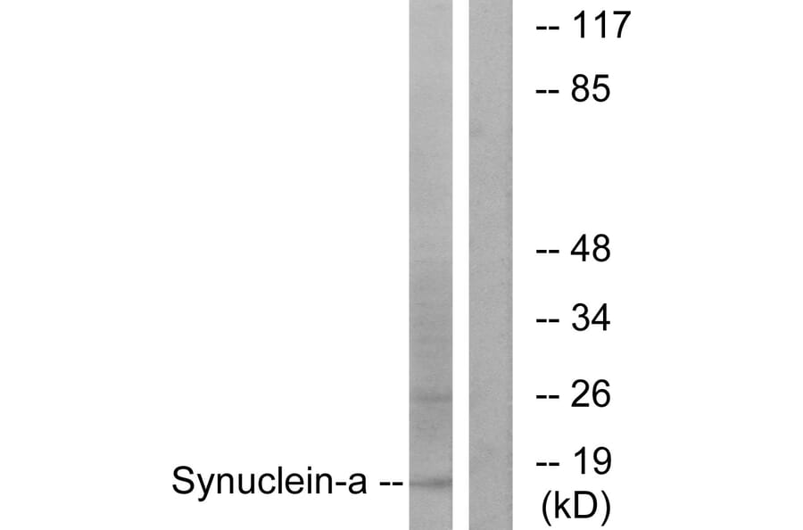 Western Blot - Anti-Synuclein-alpha Antibody (B7235) - Antibodies.com
