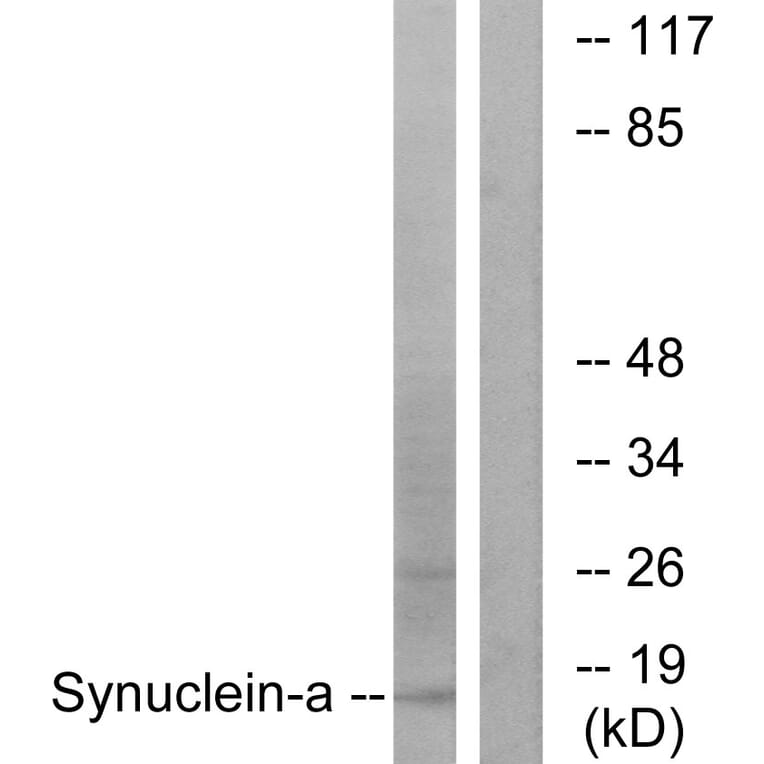 Western Blot - Anti-Synuclein-alpha Antibody (B7235) - Antibodies.com