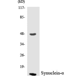 Western Blot - Anti-Synuclein-alpha Antibody (R12-3577) - Antibodies.com
