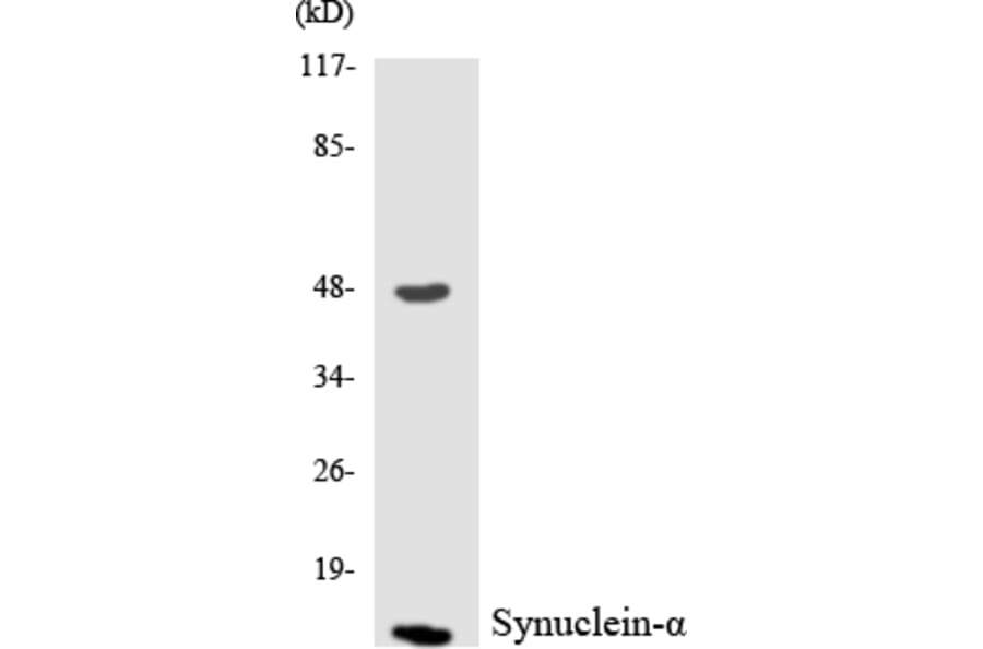Western Blot - Anti-Synuclein-alpha Antibody (R12-3577) - Antibodies.com