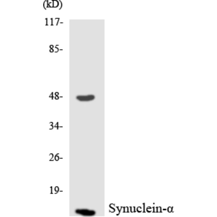 Western Blot - Anti-Synuclein-alpha Antibody (R12-3577) - Antibodies.com