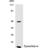 Western Blot - Anti-Synuclein-alpha Antibody (R12-3577) - Antibodies.com
