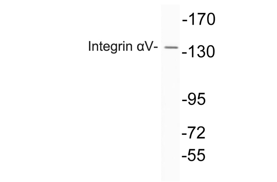 Western Blot - Anti-Integrin alphaV Antibody (R12-2222) - Antibodies.com