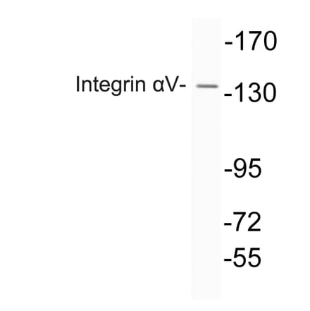 Western Blot - Anti-Integrin alphaV Antibody (R12-2222) - Antibodies.com