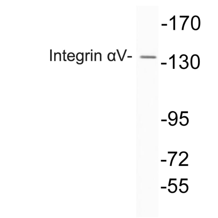 Western Blot - Anti-Integrin alphaV Antibody (R12-2222) - Antibodies.com