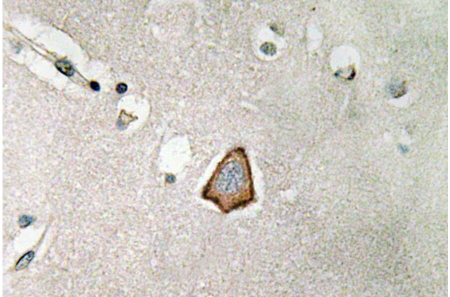 Immunohistochemistry - Anti-Integrin alphaV Antibody (R12-2222) - Antibodies.com