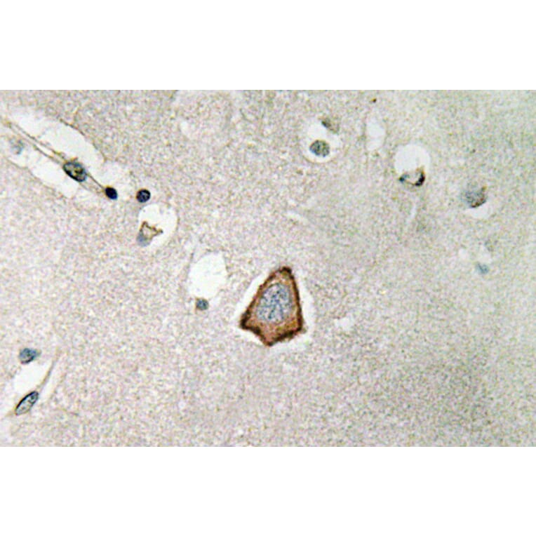 Immunohistochemistry - Anti-Integrin alphaV Antibody (R12-2222) - Antibodies.com