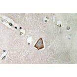 Immunohistochemistry - Anti-Integrin alphaV Antibody (R12-2222) - Antibodies.com