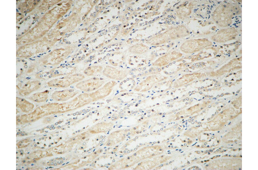 Immunohistochemistry - Anti-Integrin alphaV Antibody (R12-2222) - Antibodies.com