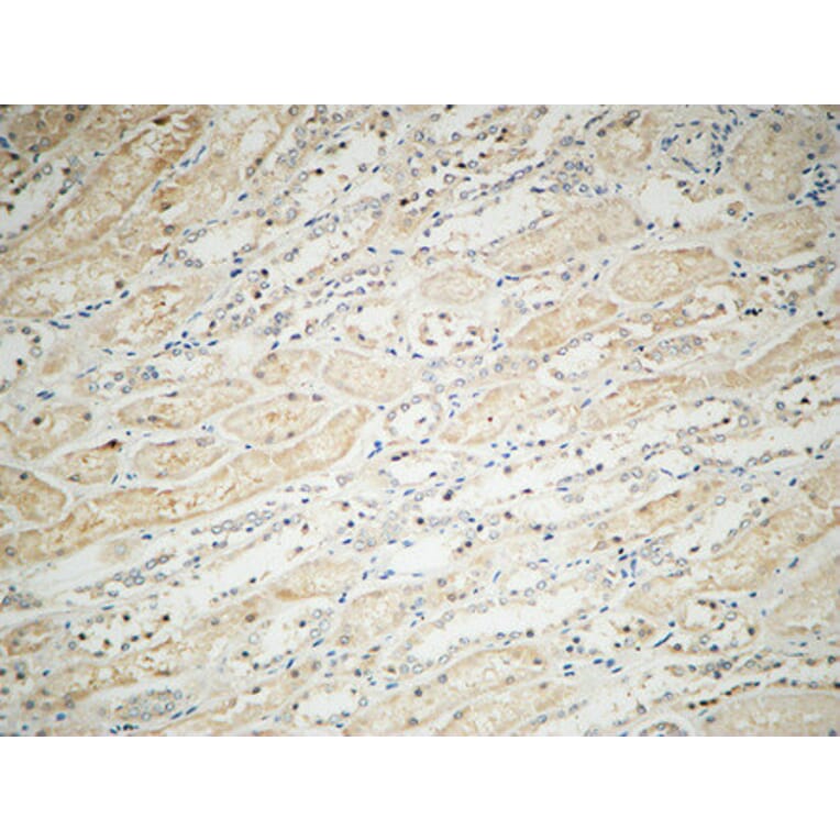 Immunohistochemistry - Anti-Integrin alphaV Antibody (R12-2222) - Antibodies.com