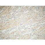 Immunohistochemistry - Anti-Integrin alphaV Antibody (R12-2222) - Antibodies.com