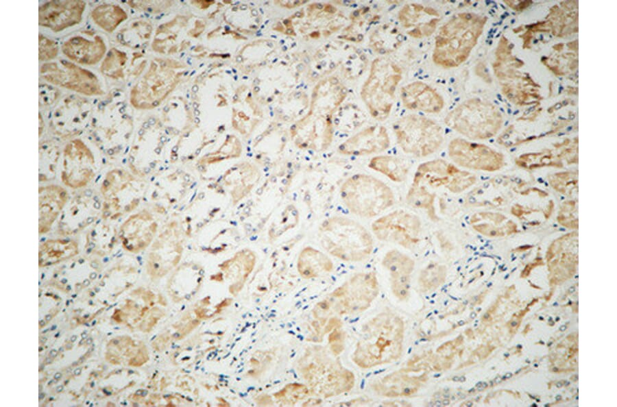 Immunohistochemistry - Anti-Integrin alphaV Antibody (R12-2222) - Antibodies.com