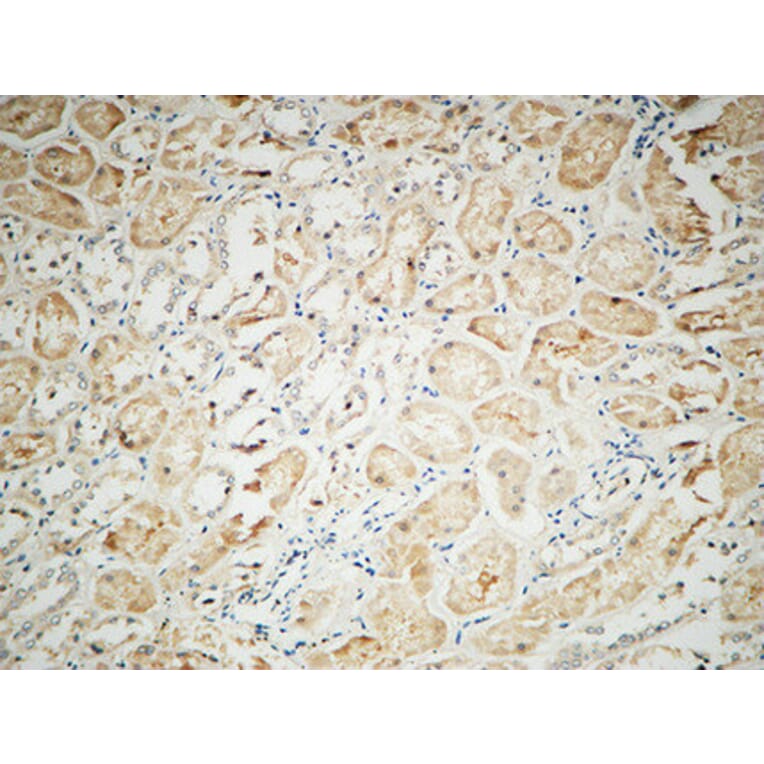 Immunohistochemistry - Anti-Integrin alphaV Antibody (R12-2222) - Antibodies.com