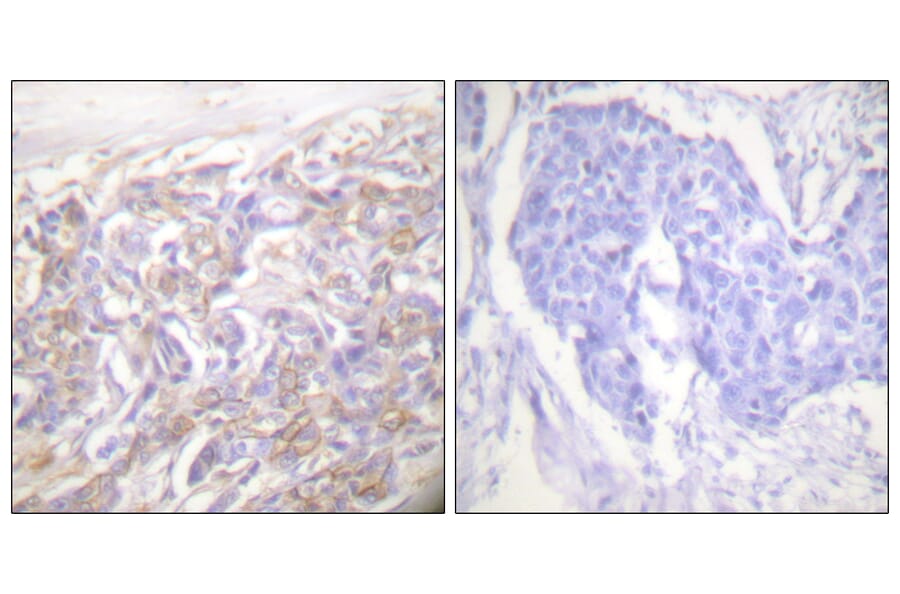 Immunohistochemistry - Anti-TNF Receptor I Antibody (C0375) - Antibodies.com