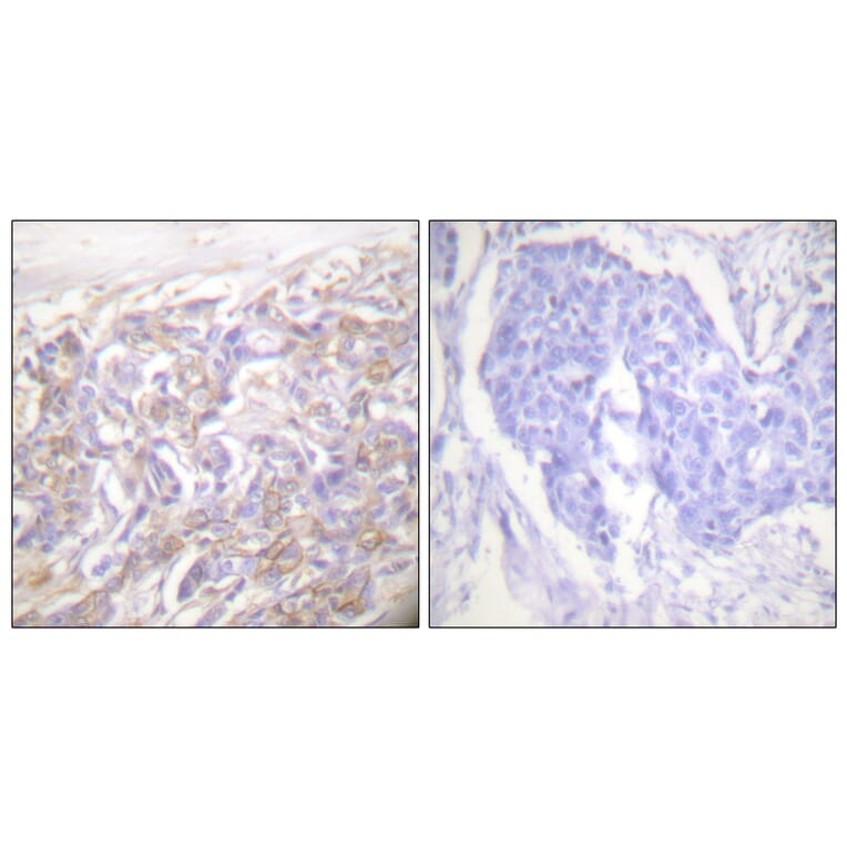 Immunohistochemistry - Anti-TNF Receptor I Antibody (C0375) - Antibodies.com