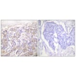 Immunohistochemistry - Anti-TNF Receptor I Antibody (C0375) - Antibodies.com
