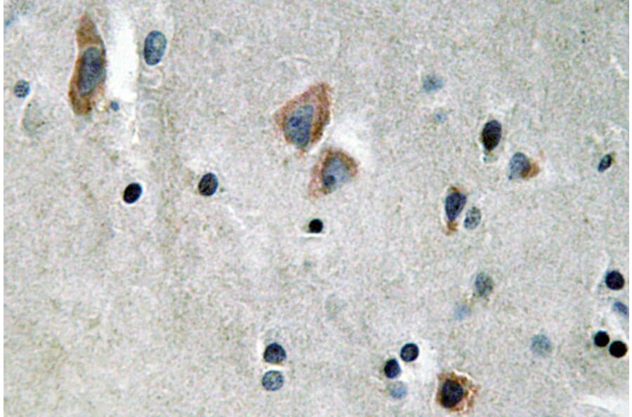 Immunohistochemistry - Anti-Cytokeratin 14 Antibody (R12-2107) - Antibodies.com