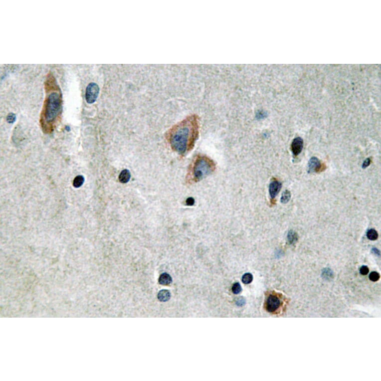 Immunohistochemistry - Anti-Cytokeratin 14 Antibody (R12-2107) - Antibodies.com
