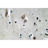 Immunohistochemistry - Anti-Cytokeratin 14 Antibody (R12-2107) - Antibodies.com