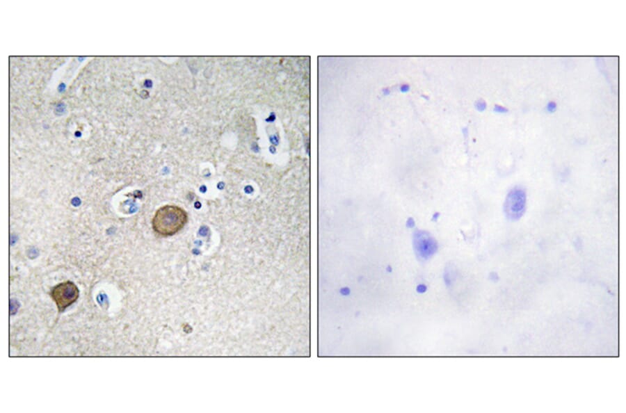 Immunohistochemistry - Anti-Catenin-alpha1 Antibody (B1140) - Antibodies.com