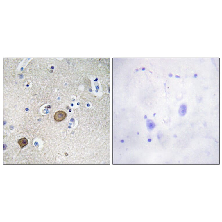 Immunohistochemistry - Anti-Catenin-alpha1 Antibody (B1140) - Antibodies.com