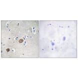 Immunohistochemistry - Anti-Catenin-alpha1 Antibody (B1140) - Antibodies.com