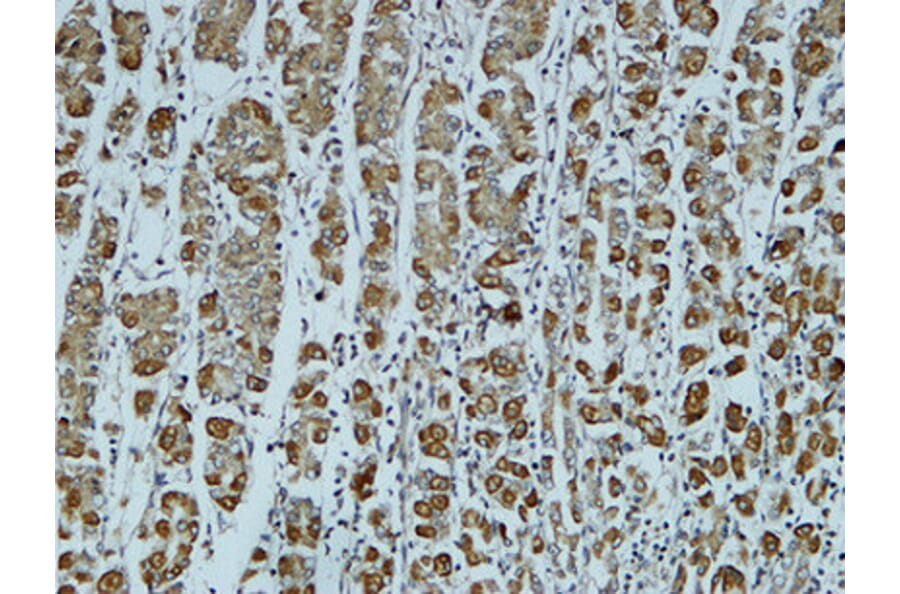 Immunohistochemistry - Anti-Catenin-alpha1 Antibody (B1140) - Antibodies.com