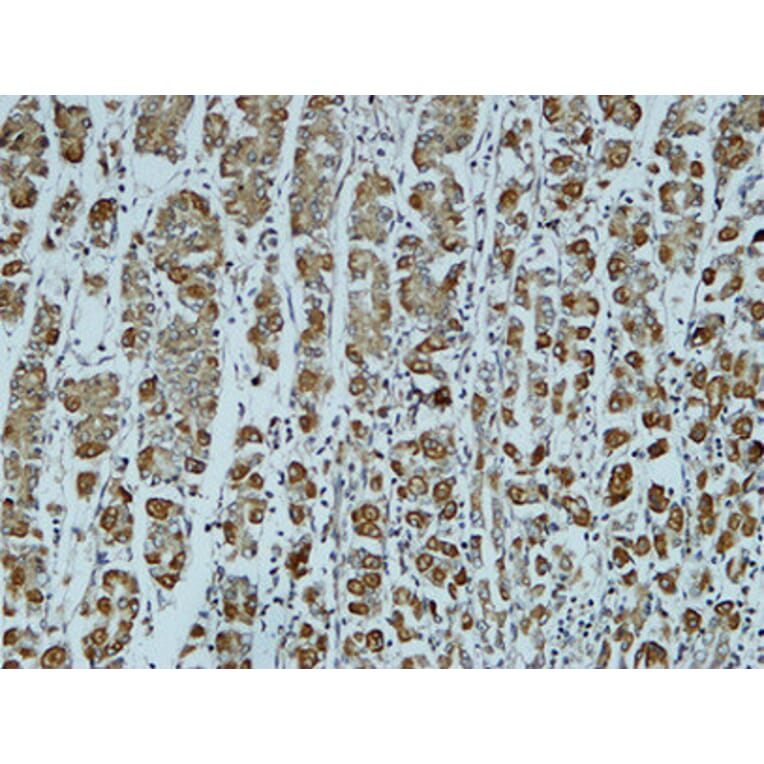 Immunohistochemistry - Anti-Catenin-alpha1 Antibody (B1140) - Antibodies.com