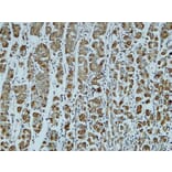 Immunohistochemistry - Anti-Catenin-alpha1 Antibody (B1140) - Antibodies.com