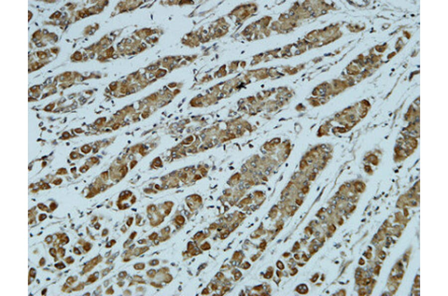 Immunohistochemistry - Anti-Catenin-alpha1 Antibody (B1140) - Antibodies.com