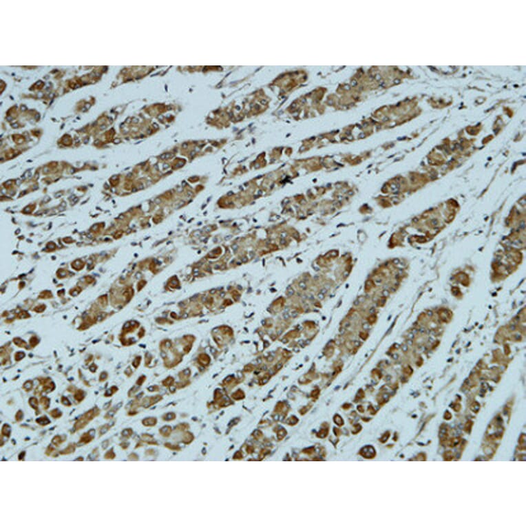 Immunohistochemistry - Anti-Catenin-alpha1 Antibody (B1140) - Antibodies.com