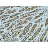 Immunohistochemistry - Anti-Catenin-alpha1 Antibody (B1140) - Antibodies.com