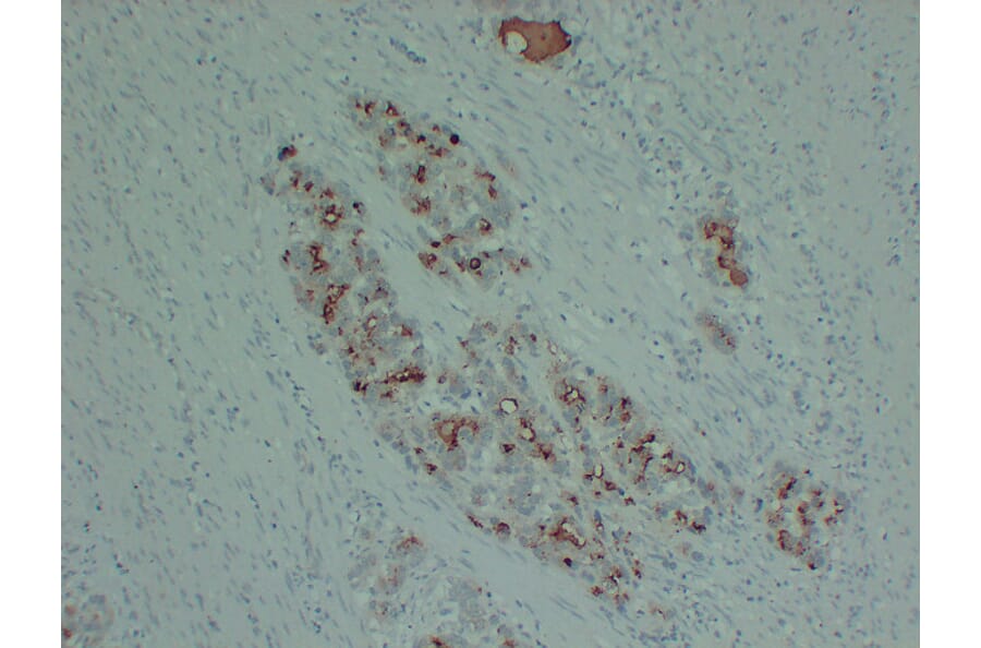 Immunohistochemistry - Anti-PIK3CA H1047R Antibody (V0111) - Antibodies.com