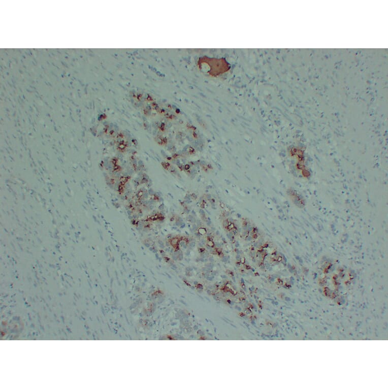 Immunohistochemistry - Anti-PIK3CA H1047R Antibody (V0111) - Antibodies.com