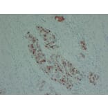 Immunohistochemistry - Anti-PIK3CA H1047R Antibody (V0111) - Antibodies.com