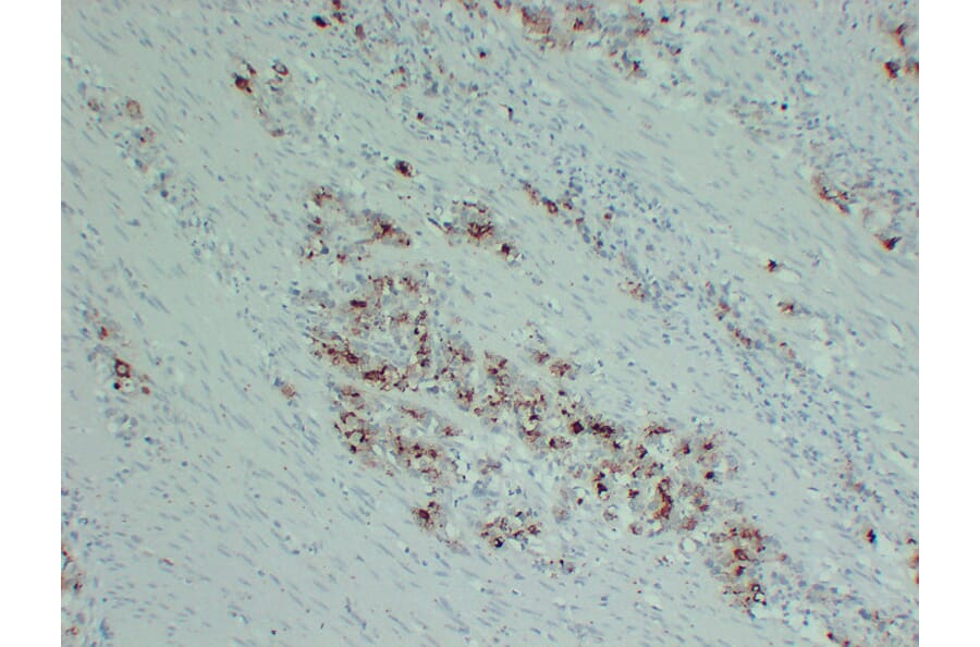 Immunohistochemistry - Anti-PIK3CA H1047R Antibody (V0111) - Antibodies.com
