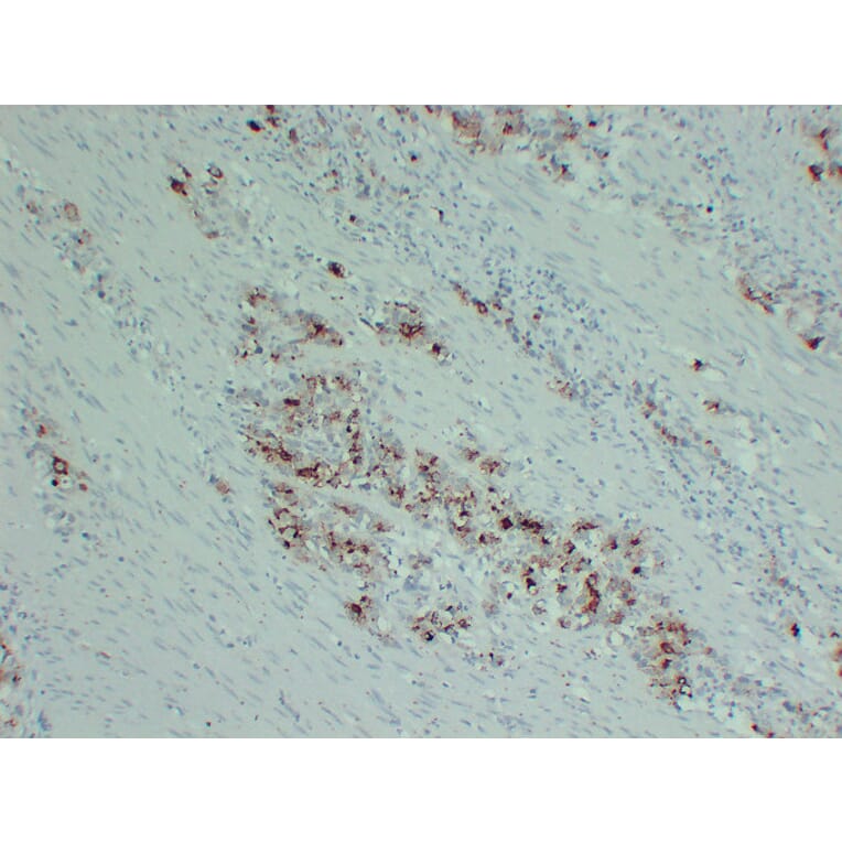 Immunohistochemistry - Anti-PIK3CA H1047R Antibody (V0111) - Antibodies.com