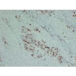 Immunohistochemistry - Anti-PIK3CA H1047R Antibody (V0111) - Antibodies.com