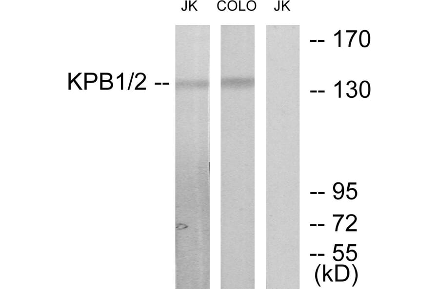 Western Blot - Anti-KPB1 + KPB2 Antibody (C10626) - Antibodies.com