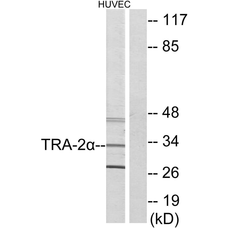 Western Blot - Anti-TRA-2 alpha Antibody (C11000) - Antibodies.com