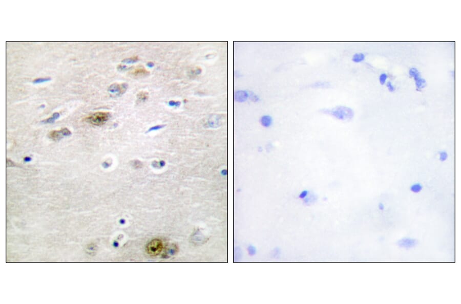 Immunohistochemistry - Anti-TRA-2 alpha Antibody (C11000) - Antibodies.com