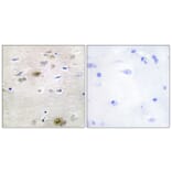 Immunohistochemistry - Anti-TRA-2 alpha Antibody (C11000) - Antibodies.com