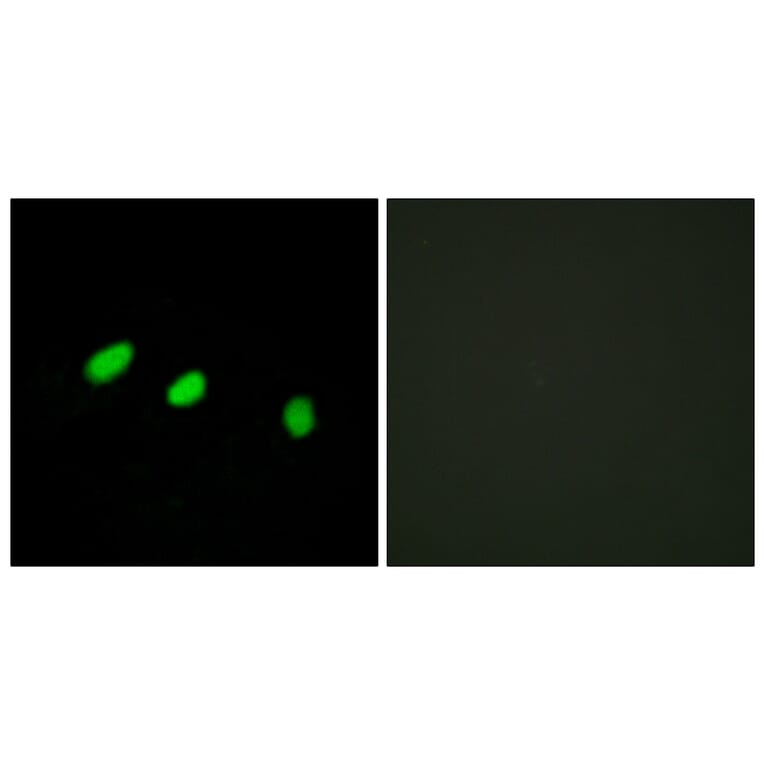 Immunofluorescence - Anti-TRA-2 alpha Antibody (C11000) - Antibodies.com