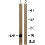 Western Blot - Anti-Histone H2B Antibody (D0024) - Antibodies.com