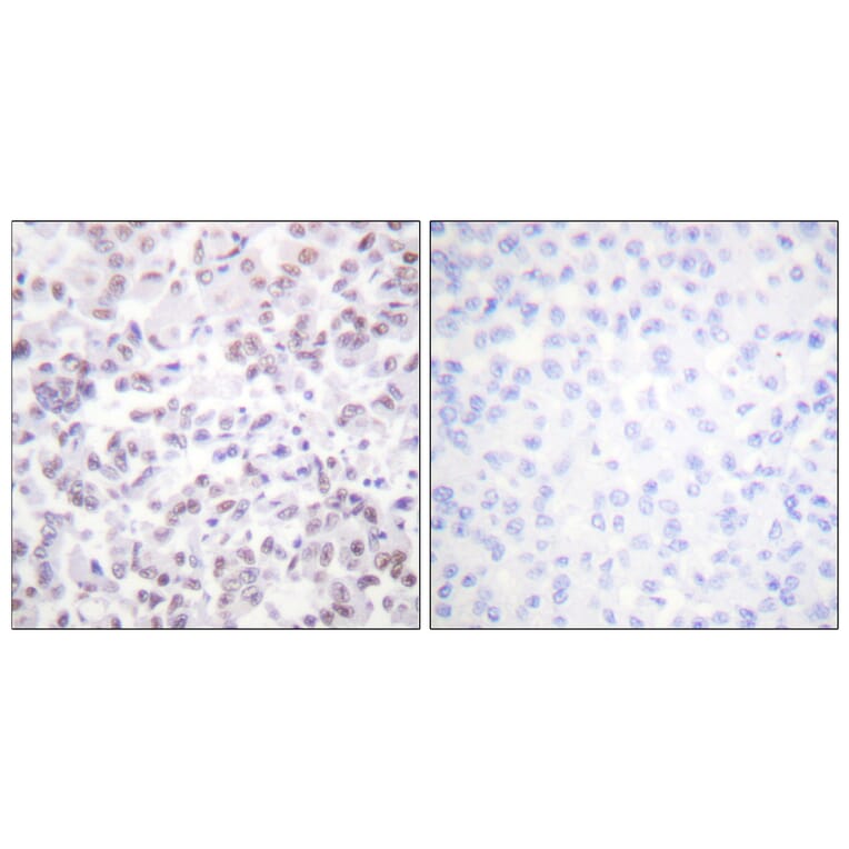 Immunohistochemistry - Anti-Histone H2B Antibody (D0024) - Antibodies.com