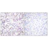 Immunohistochemistry - Anti-Histone H2B Antibody (D0024) - Antibodies.com