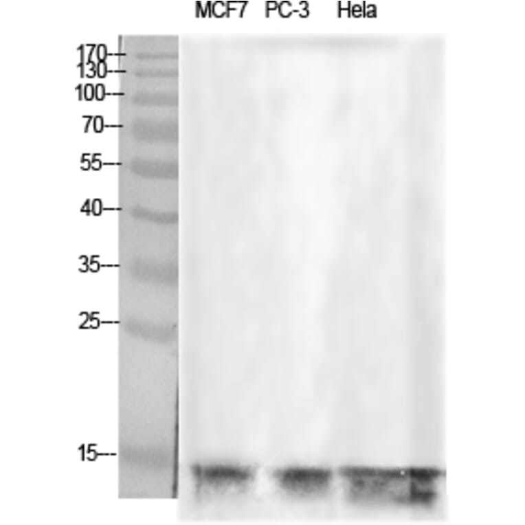 Western Blot - Anti-Histone H2B Antibody (D0024) - Antibodies.com