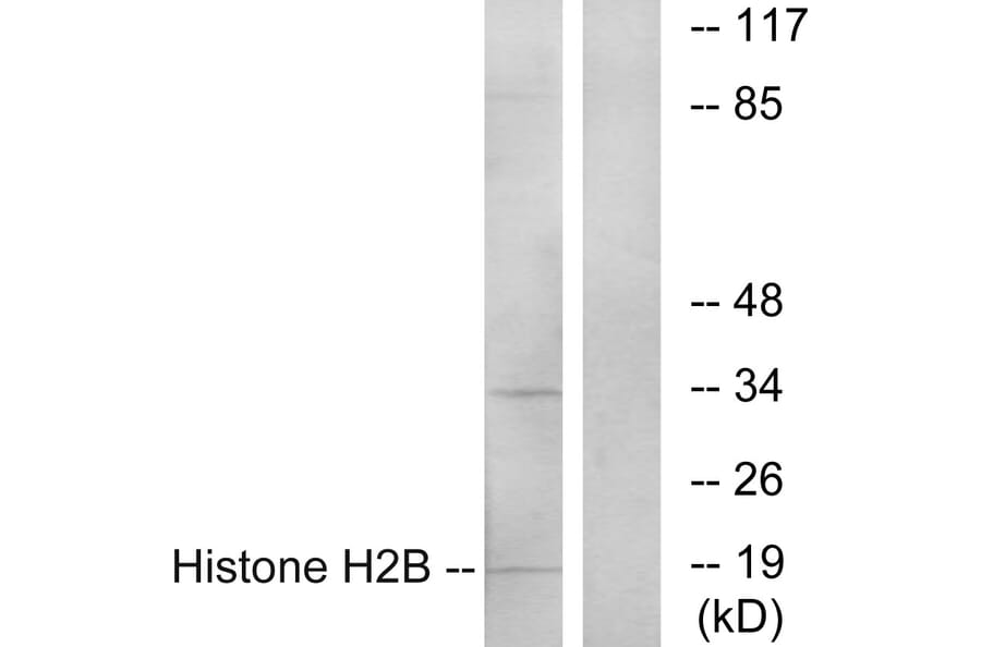Western Blot - Anti-Histone H2B Antibody (C11456) - Antibodies.com